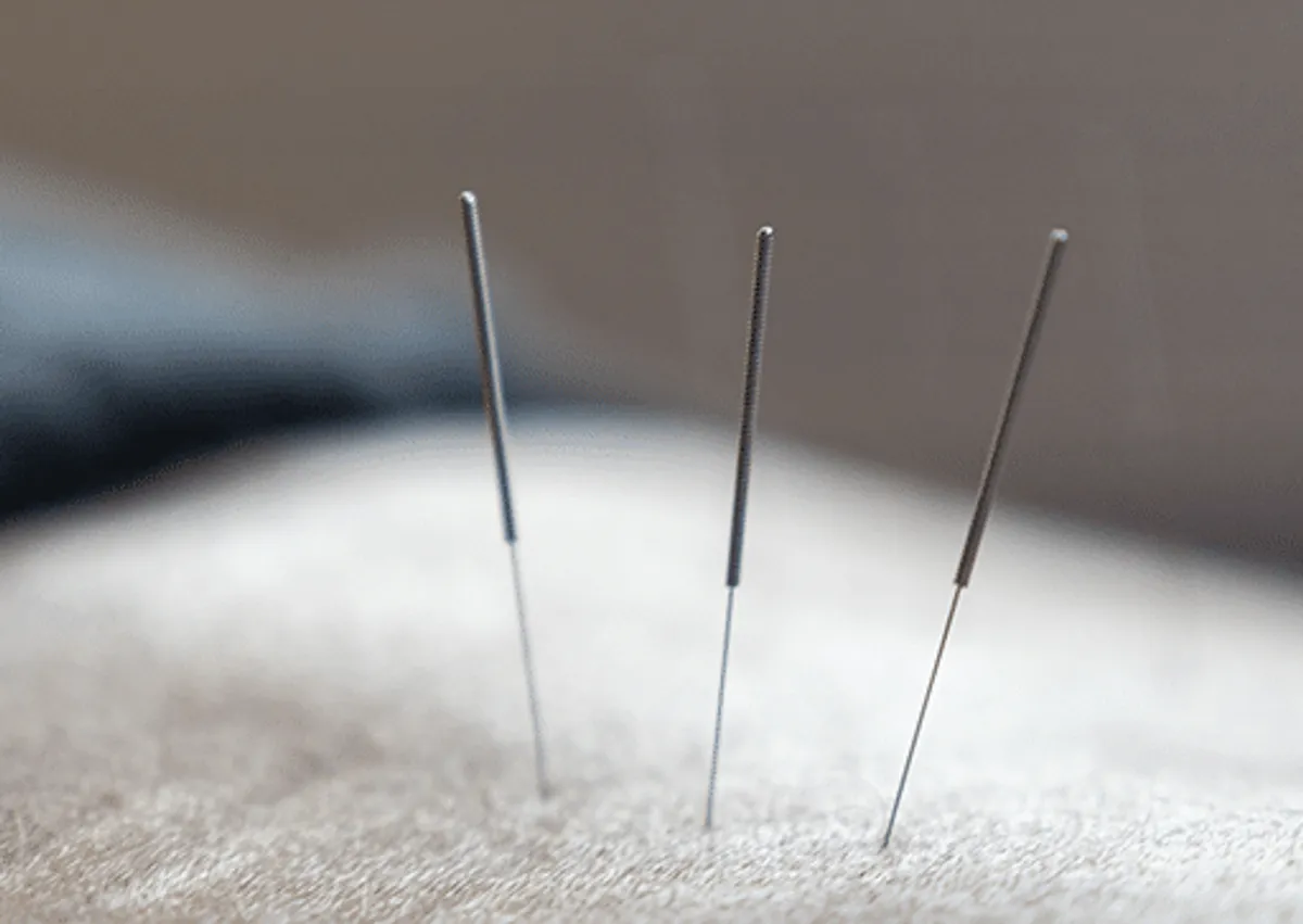 Akupunktur behandling hos iCare Massage i Lyngby